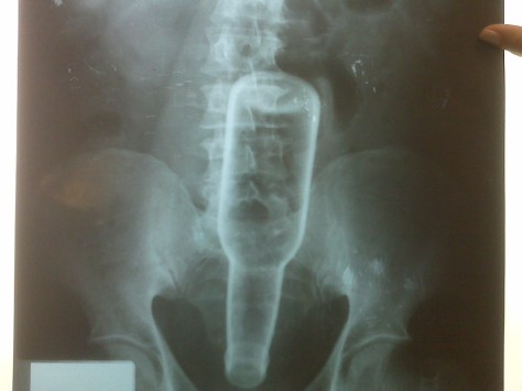 ...Pues empalamiento no es.