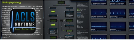 ACLS Rhythms – Guías de reanimación y consejero de ECG