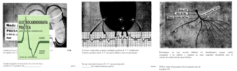 Electrocardiografia practica- Dubin Dale
